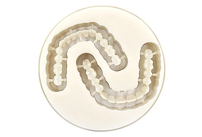 digital partial dentures