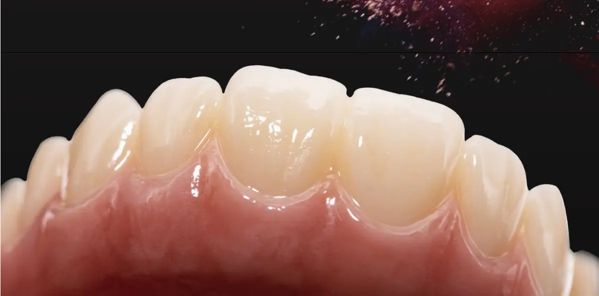 A solução tudo-em-um para restaurações dentárias-ENORME MM-4D chegada de zircônia!