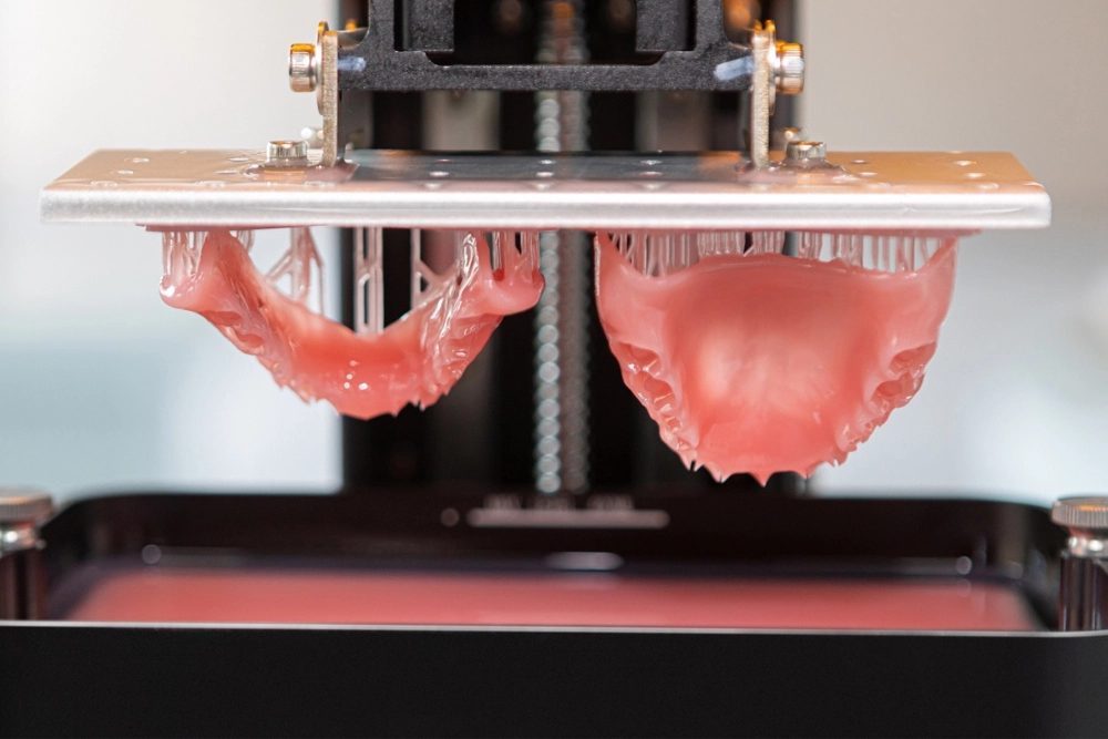 Fluxo de trabalho de dentadura de impressão digital