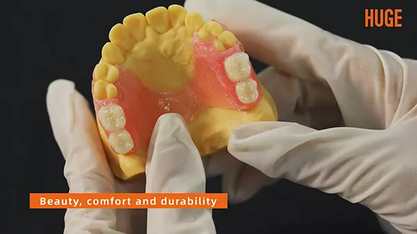 Fluxo de trabalho de dentaduras parciais flexíveis