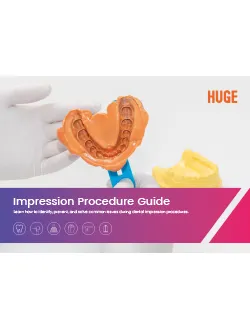 HUGE PERFIT Guia de Impressão & Solução de Problemas