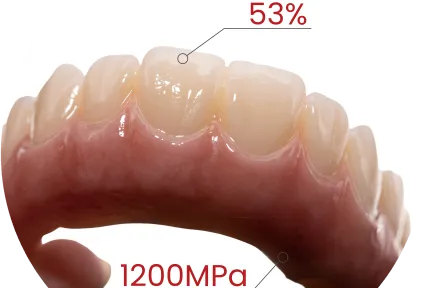 Pronto para Arco Completo. Estética Inclusa. Veja a Zircônia MM-4D em Casos Clínicos Reais.