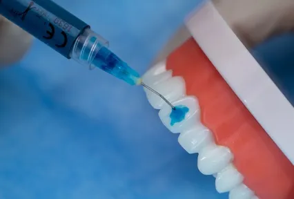 HUGE Gel de Condicionamento com Ácido Fosfórico a 37%