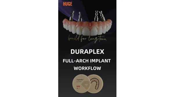 Fluxo de Trabalho para Implante de Arco Completo com DuraPlex PMMA e Gumimic